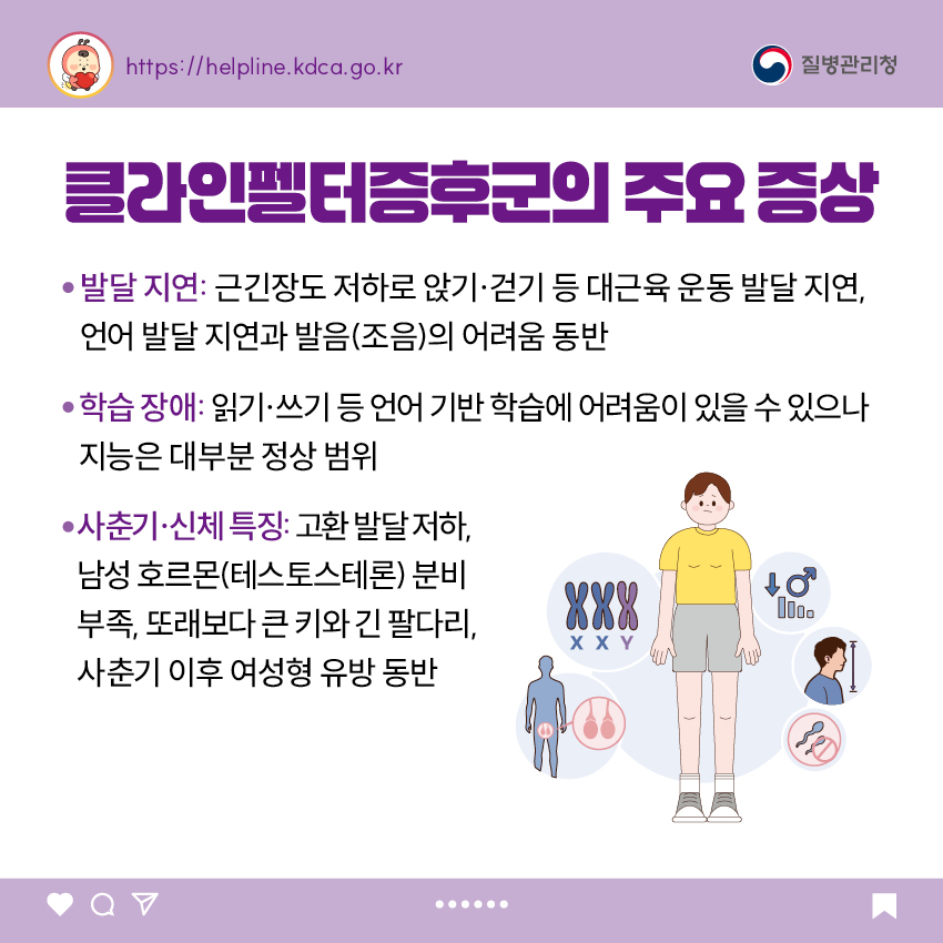 클라인펠터증후군의 주요 증상 - 발달 지연: 근긴장도 저하로 앉기·걷기 등 대근육 운동 발달 지연, 언어 발달 지연과 발음(조음)의 어려움 동반 - 학습 장애: 읽기·쓰기 등 언어 기반 학습에 어려움이 있을 수 있으나 지능은 대부분 정상 범위 - 사춘기·신체 특징: 고환 발달 저하, 남성 호르몬(테스토스테론) 분비 부족, 또래보다 큰 키와 긴 팔다리, 사춘기 이후 여성형 유방 동반